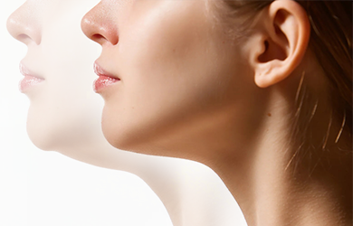 Локальная коррекция жировых отложений